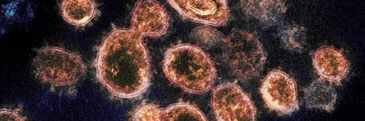 http://www.ihu.unisinos.br/images/ihu/2020/03/10-03_coronavirus_foto_NIH_Image_Gallery_flickr.jpg
